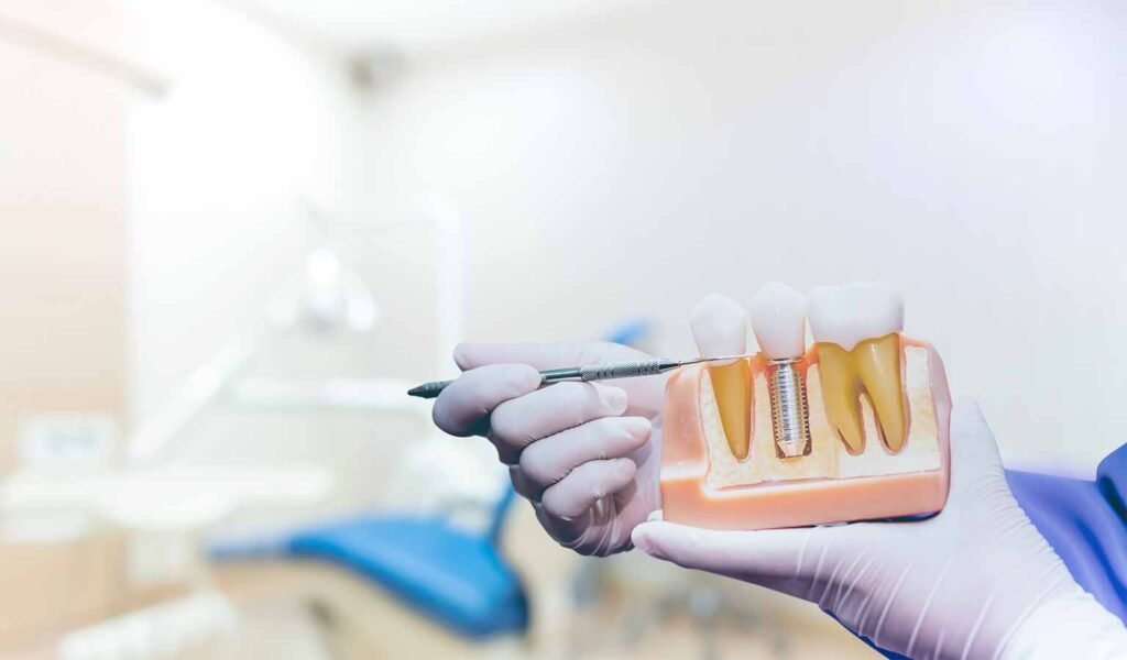 SG全面牙齿护理推荐